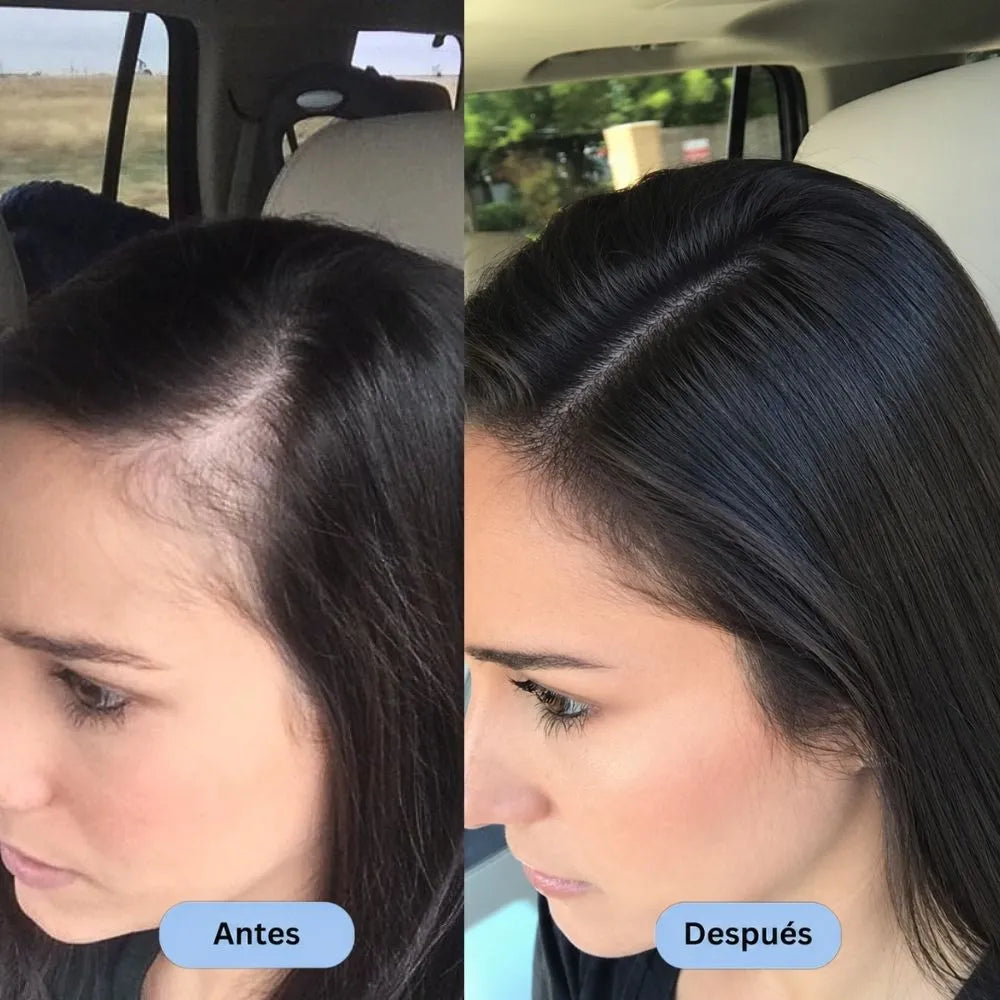 Recupera la Fuerza y el Brillo de tu Cabello desde la Primera Ducha con AURALIS™